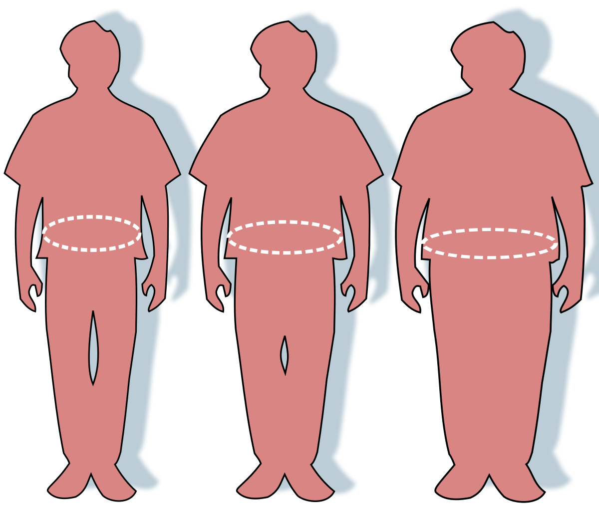 South Africa's Obesity Epidemic